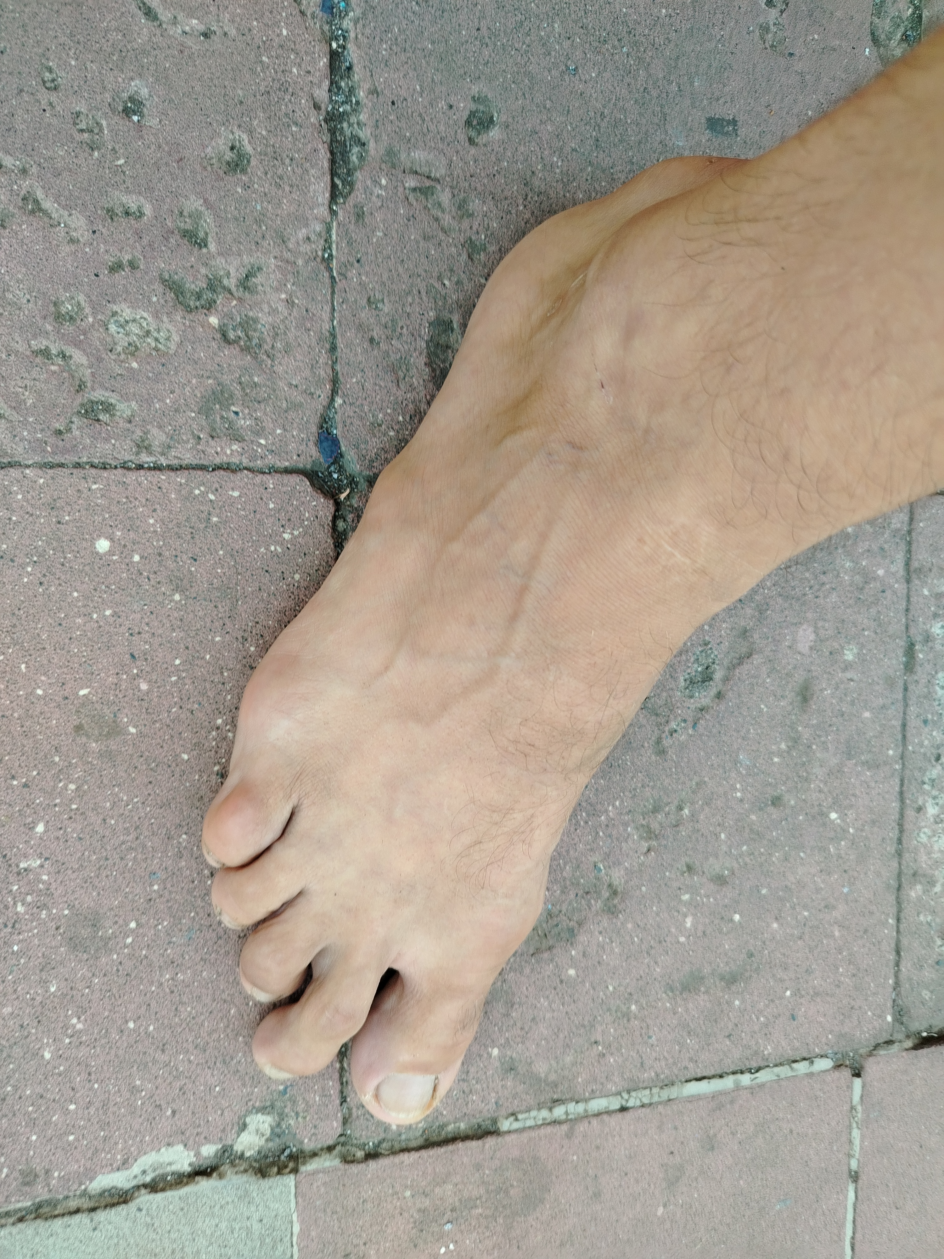 Y